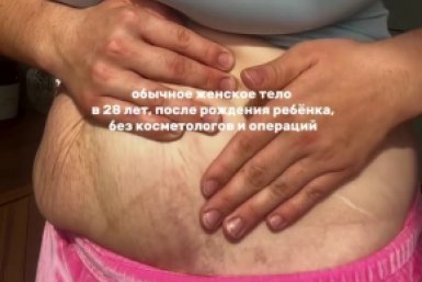 Блогер из Иркутска показала тело после родов и вызвала шквал критики Из соцсети блогера