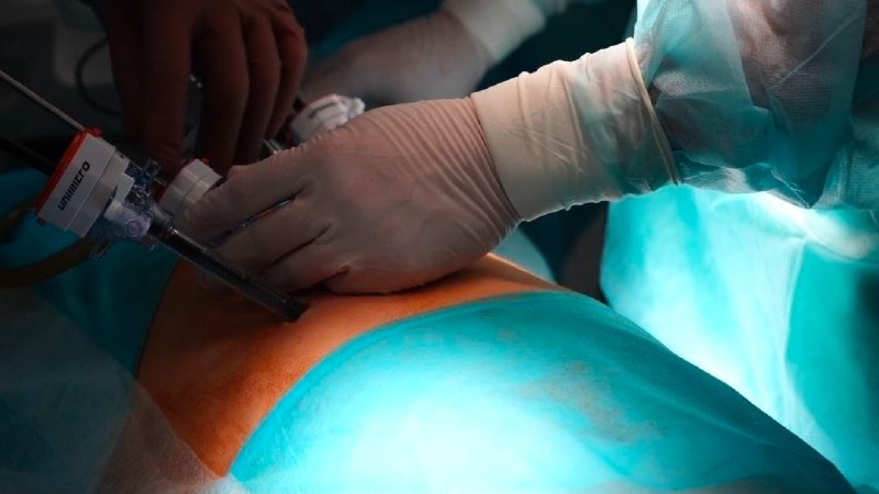 Иркутские хирурги успешно прооперировали ребенка с редкой наследственной анемией Тг-канал (18+) главного врача Иркутской областной детской клинической больницы.