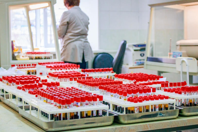 Иркутский областной центр СПИД проводит бесплатное и анонимное обследование на ВИЧ